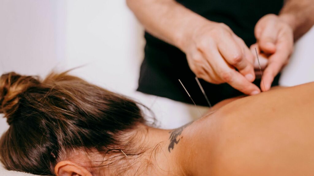 physiotherapist performing dry needling
